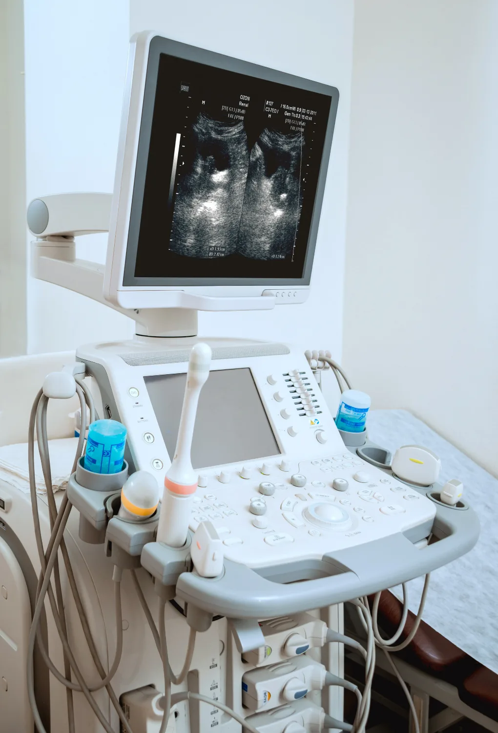 preguntas ultrasonografia irapuato gto